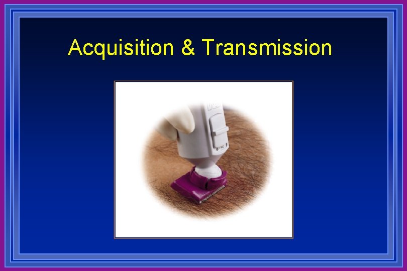 Acquisition & Transmission 