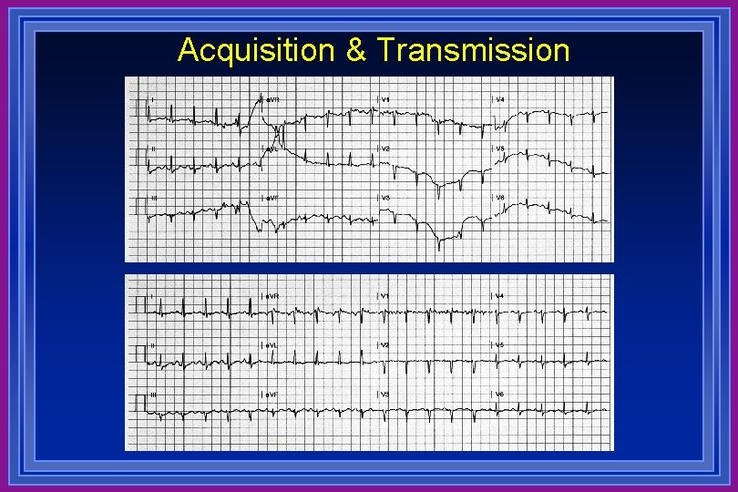 Acquisition & Transmission 