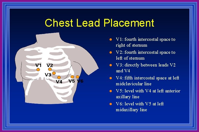 Chest Lead Placement l l l V 1: fourth intercostal space to right of