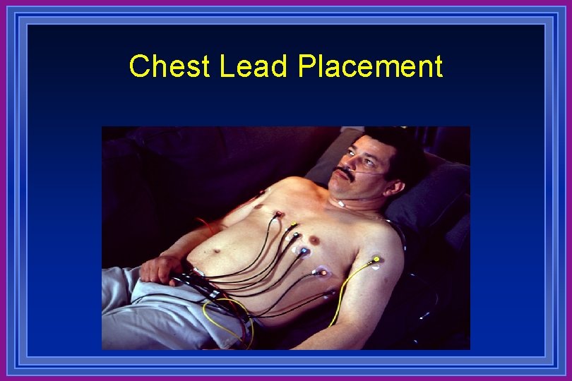 Chest Lead Placement 