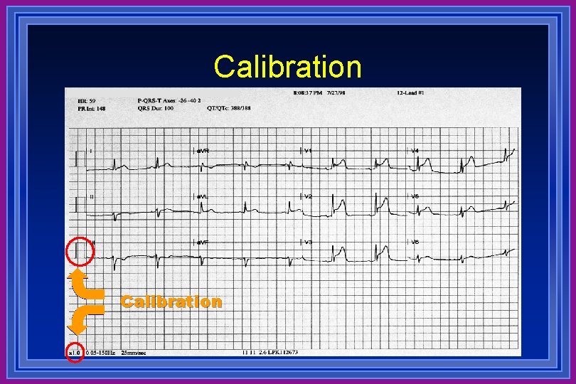 Calibration 