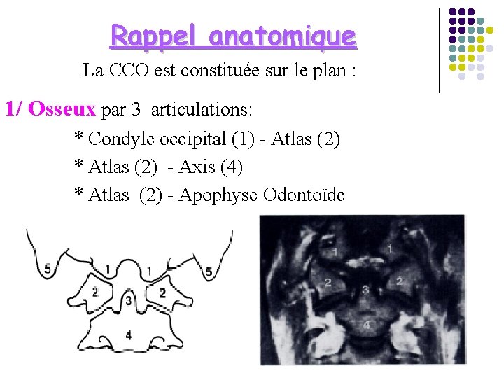 Rappel anatomique La CCO est constituée sur le plan : 1/ Osseux par 3