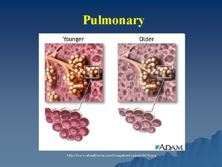 Pulmonary http: //www. ahealthyme. com/Imagebank/adam/8676. jpg 