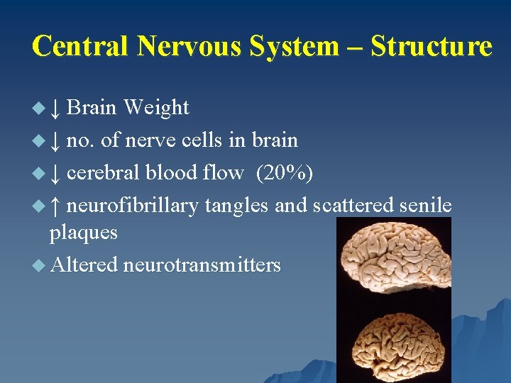 Central Nervous System – Structure u ↓ Brain Weight u ↓ no. of nerve