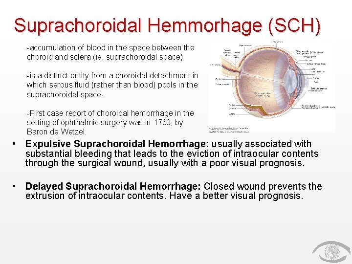 Suprachoroidal Hemmorhage (SCH) -accumulation of blood in the space between the choroid and sclera