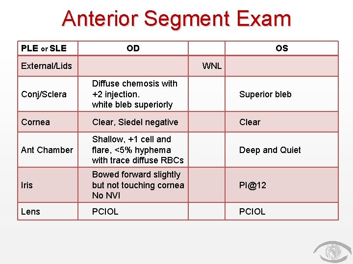 Anterior Segment Exam PLE or SLE OD External/Lids OS WNL Conj/Sclera Diffuse chemosis with