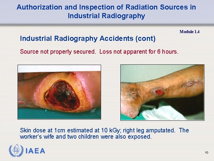 Authorization and Inspection of Radiation Sources in Industrial Radiography Module 1. 4 Industrial Radiography