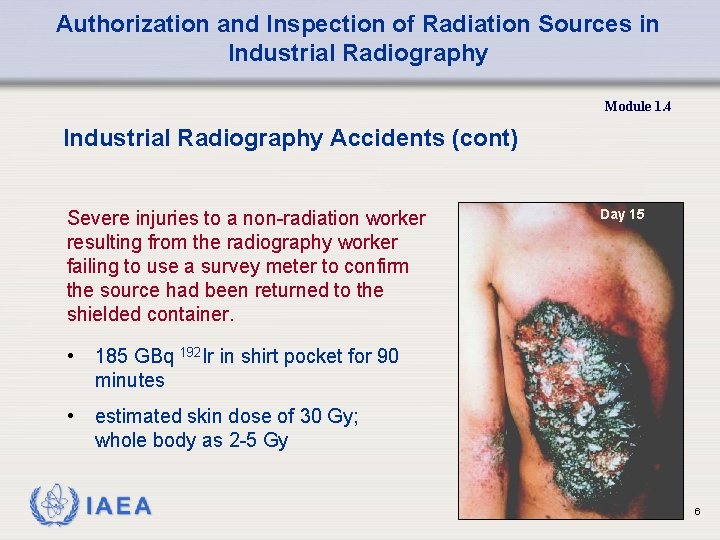 Authorization and Inspection of Radiation Sources in Industrial Radiography Module 1. 4 Industrial Radiography