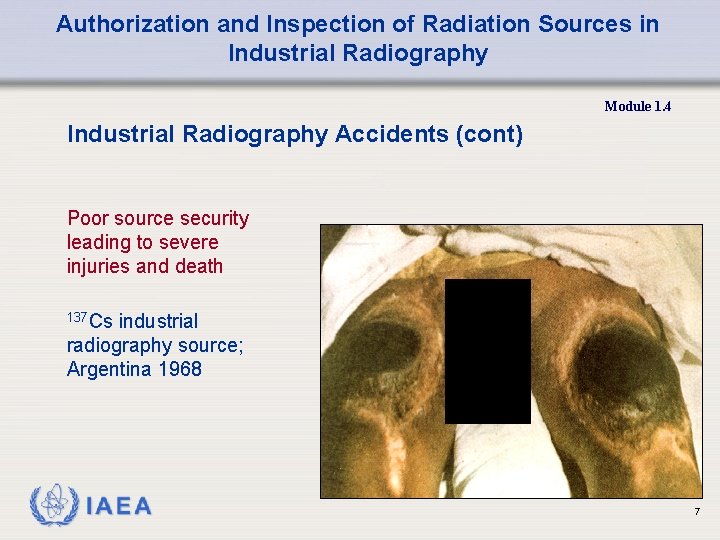 Authorization and Inspection of Radiation Sources in Industrial Radiography Module 1. 4 Industrial Radiography