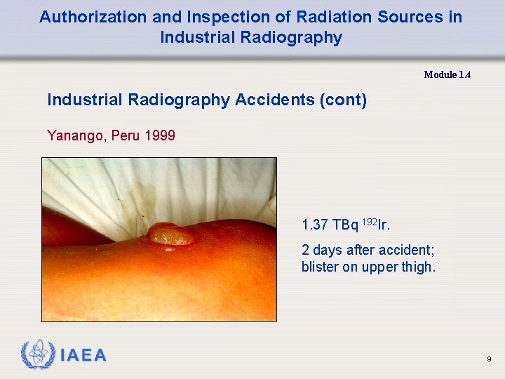 Authorization and Inspection of Radiation Sources in Industrial Radiography Module 1. 4 Industrial Radiography