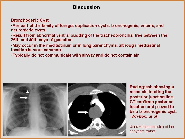 Discussion Bronchogenic Cyst • Are part of the family of foregut duplication cysts: bronchogenic,