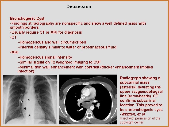 Discussion Bronchogenic Cyst • Findings at radiography are nonspecific and show a well defined