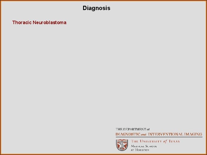 Diagnosis Thoracic Neuroblastoma 