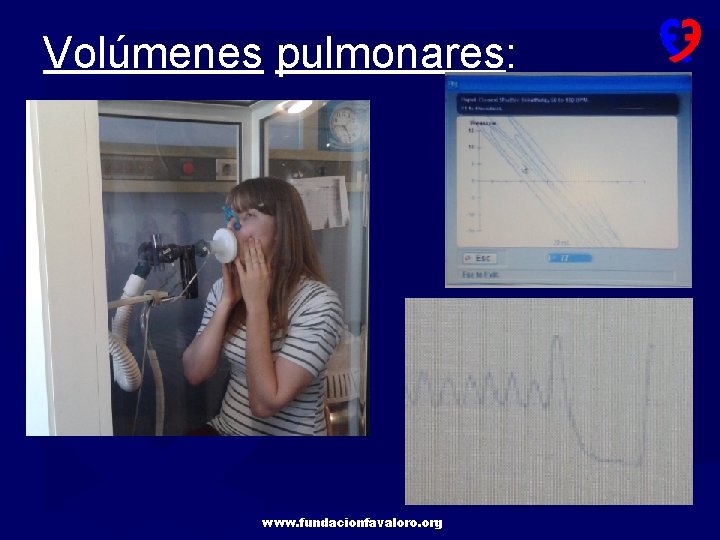 Volúmenes pulmonares: www. fundacionfavaloro. org 