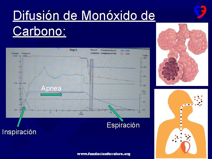 Difusión de Monóxido de Carbono: Apnea Inspiración Espiración www. fundacionfavaloro. org 