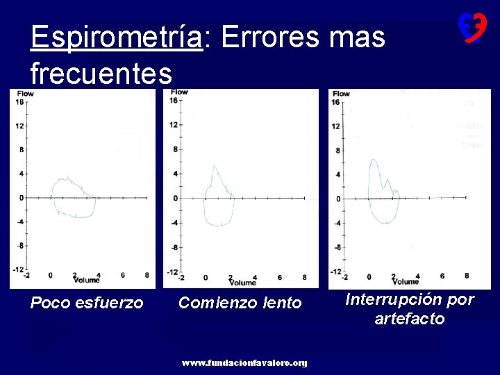 Espirometría: Errores mas frecuentes Poco esfuerzo Comienzo lento www. fundacionfavaloro. org Interrupción por artefacto