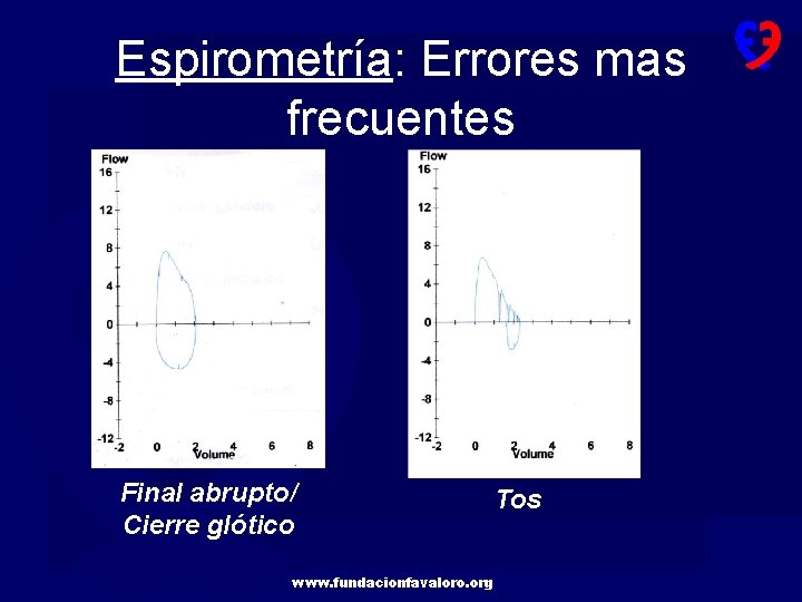 Espirometría: Errores mas frecuentes Final abrupto/ Cierre glótico www. fundacionfavaloro. org Tos 