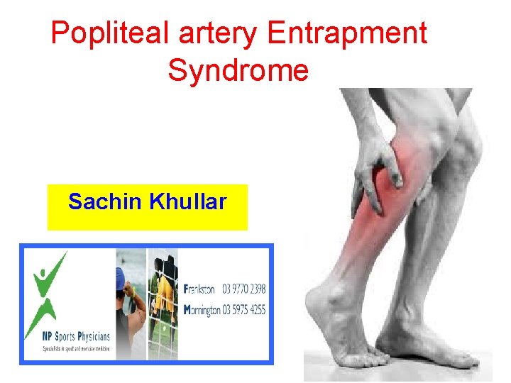 Popliteal artery Entrapment Syndrome Sachin Khullar 