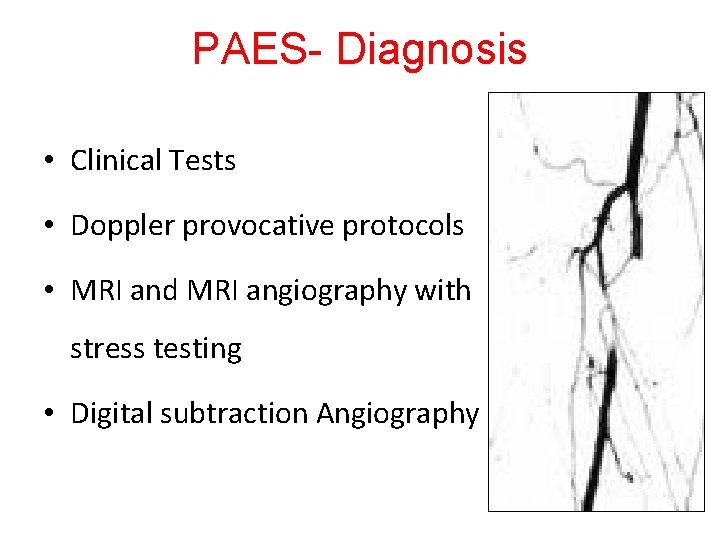 PAES- Diagnosis • Clinical Tests • Doppler provocative protocols • MRI and MRI angiography