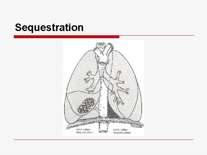 Sequestration 