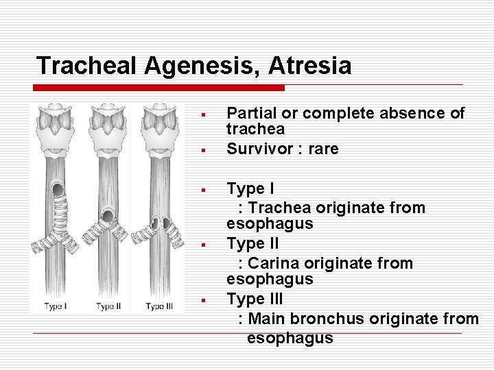 Tracheal Agenesis, Atresia § § § Partial or complete absence of trachea Survivor :