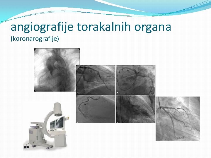 angiografije torakalnih organa (koronarografije) 