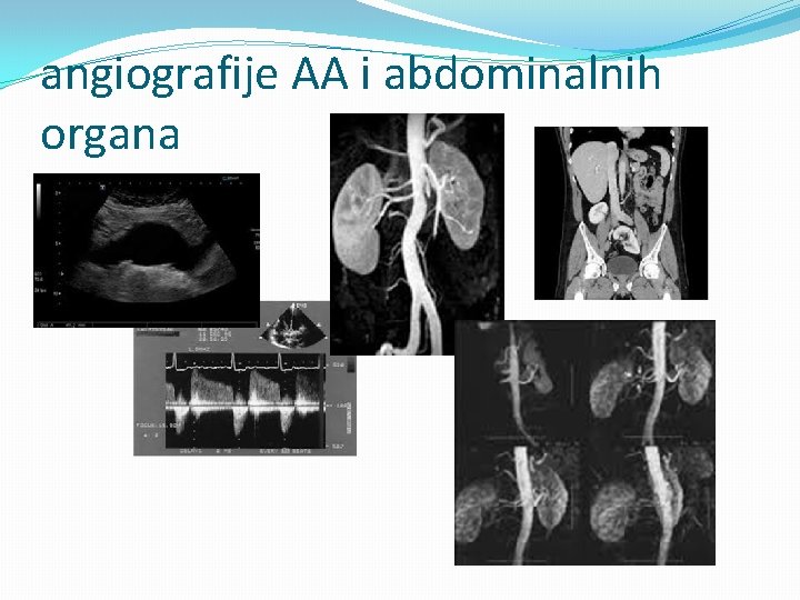 angiografije AA i abdominalnih organa 