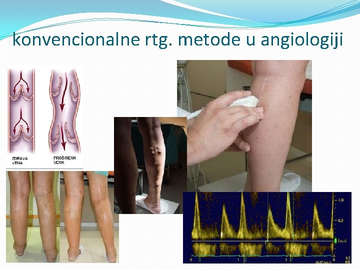 konvencionalne rtg. metode u angiologiji 