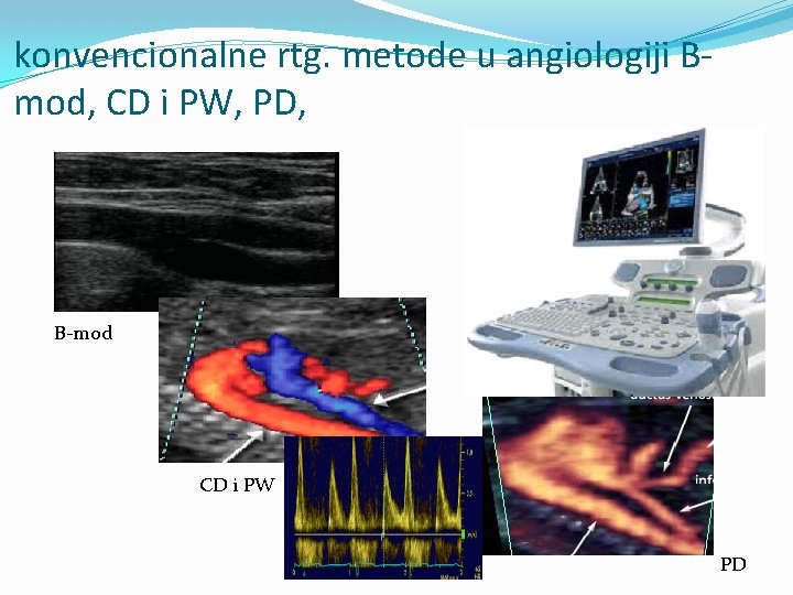 konvencionalne rtg. metode u angiologiji Bmod, CD i PW, PD, B-mod CD i PW konvencionalne rtg. metode u angiologiji Bmod, CD i PW, PD, B-mod CD i PW
