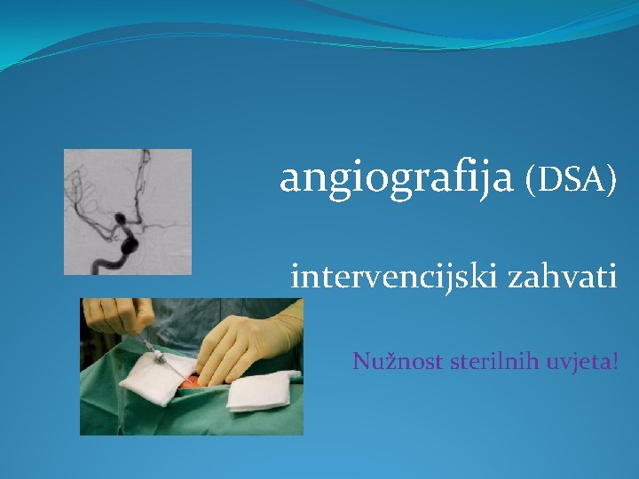 angiografija (DSA) intervencijski zahvati Nužnost sterilnih uvjeta! 