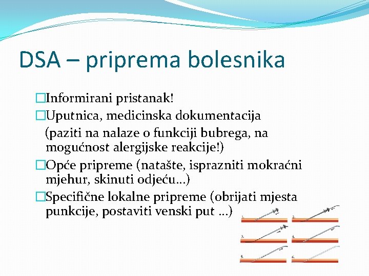 DSA – priprema bolesnika �Informirani pristanak! �Uputnica, medicinska dokumentacija (paziti na nalaze o funkciji