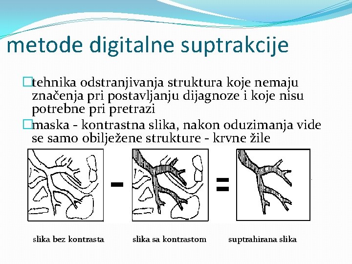 metode digitalne suptrakcije �tehnika odstranjivanja struktura koje nemaju značenja pri postavljanju dijagnoze i koje