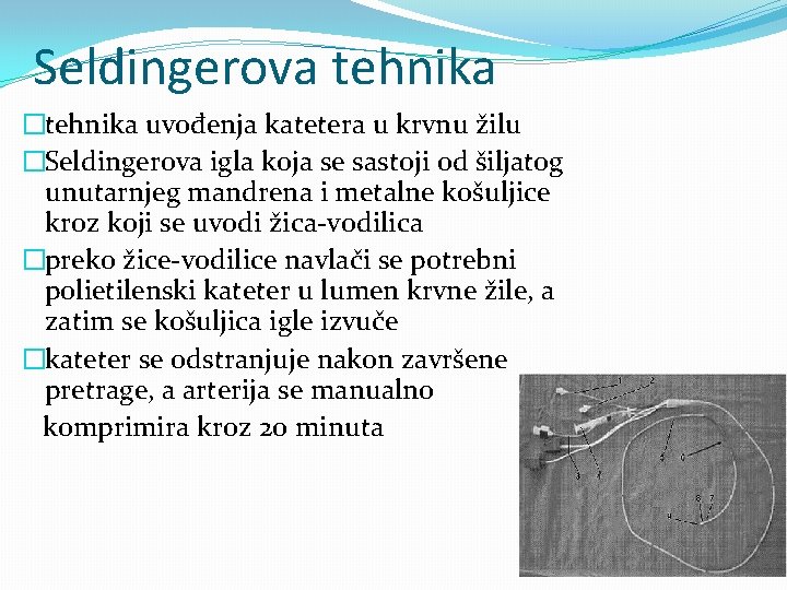 Seldingerova tehnika �tehnika uvođenja katetera u krvnu žilu �Seldingerova igla koja se sastoji od