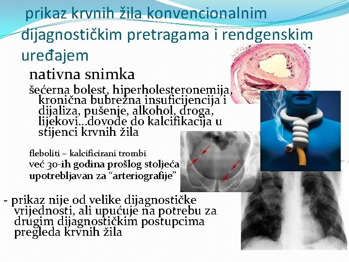 prikaz krvnih žila konvencionalnim dijagnostičkim pretragama i rendgenskim uređajem nativna snimka šećerna bolest, hiperholesteronemija,