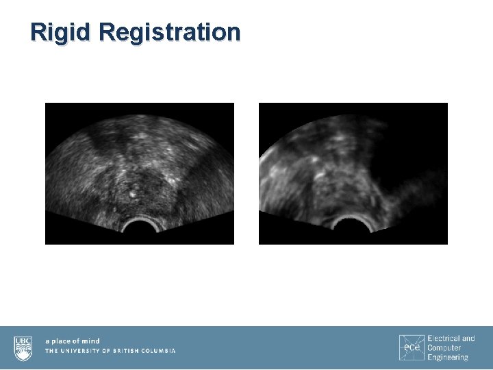 Rigid Registration 