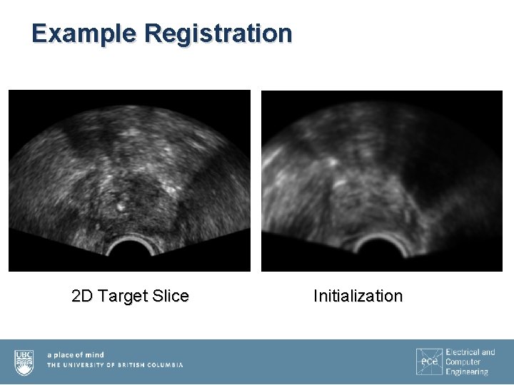 Example Registration 2 D Target Slice Initialization 