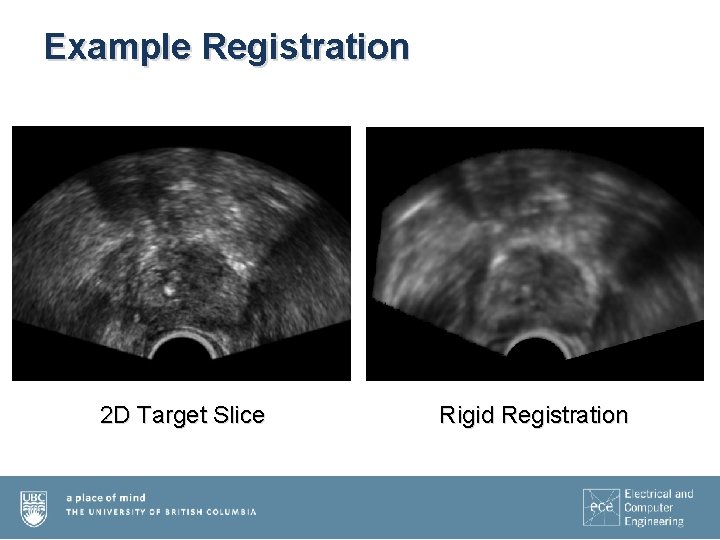 Example Registration 2 D Target Slice Rigid Registration 