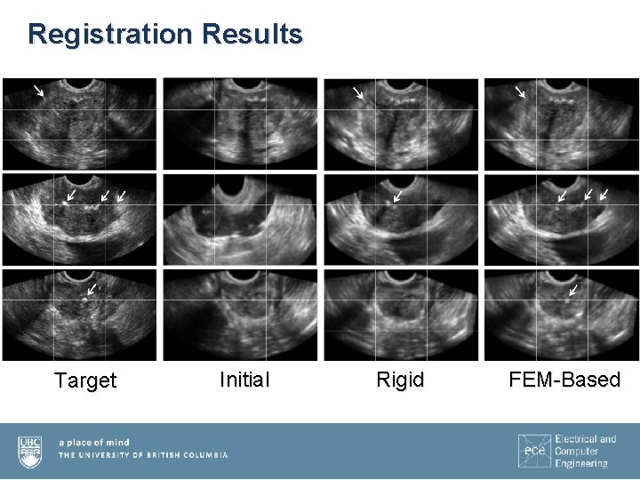 Registration Results Target Initial Rigid FEM-Based 