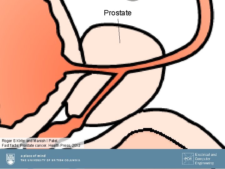 Prostate Roger S Kirby and Manish I Patel. Fast facts: Prostate cancer. Health Press,