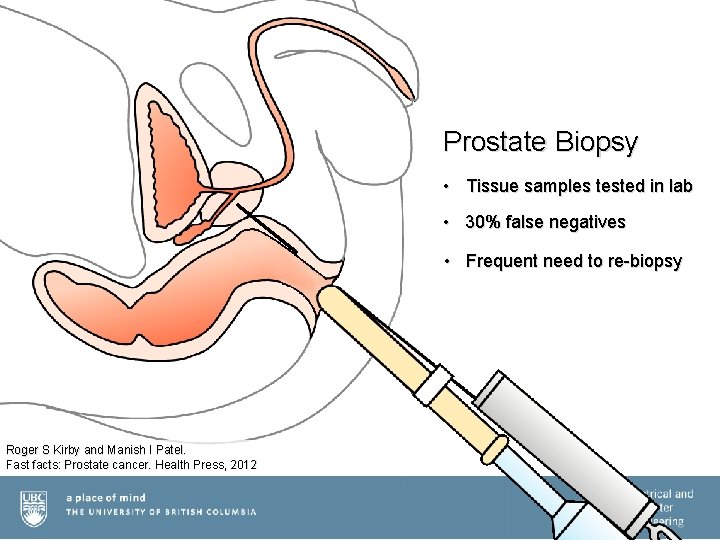 Prostate Biopsy • Tissue samples tested in lab • 30% false negatives • Frequent