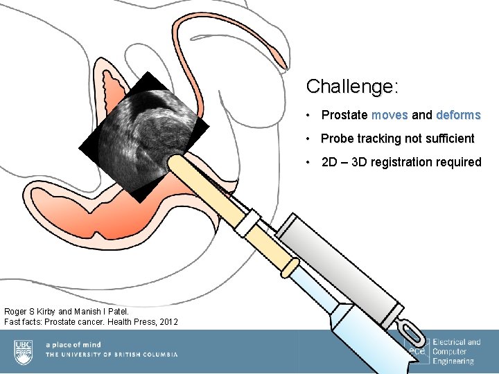 Challenge: • Prostate moves and deforms • Probe tracking not sufficient • 2 D