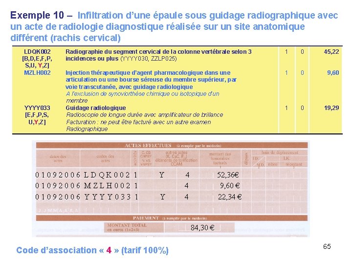 Exemple 10 – Infiltration d’une épaule sous guidage radiographique avec un acte de radiologie