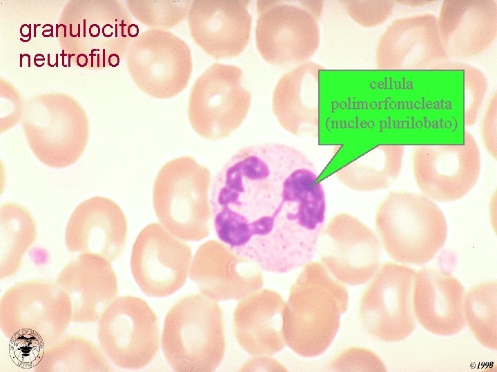 granulocito neutrofilo cellula polimorfonucleata (nucleo plurilobato) 