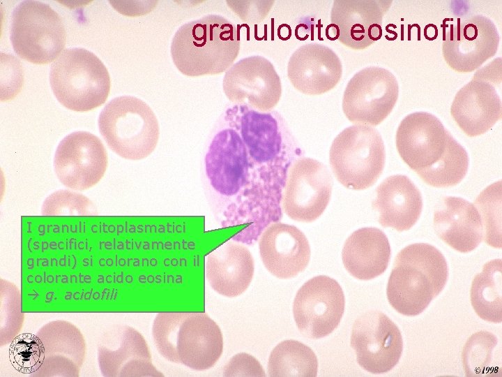 granulocito eosinofilo I granuli citoplasmatici (specifici, relativamente grandi) si colorano con il colorante acido