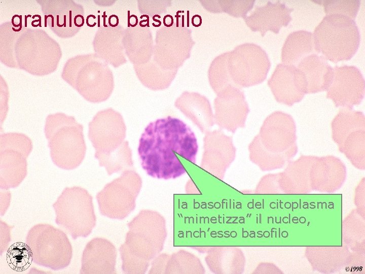 granulocito basofilo la basofilia del citoplasma “mimetizza” il nucleo, anch’esso basofilo 