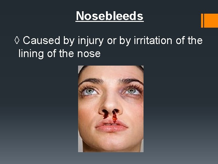 Nosebleeds ◊ Caused by injury or by irritation of the lining of the nose