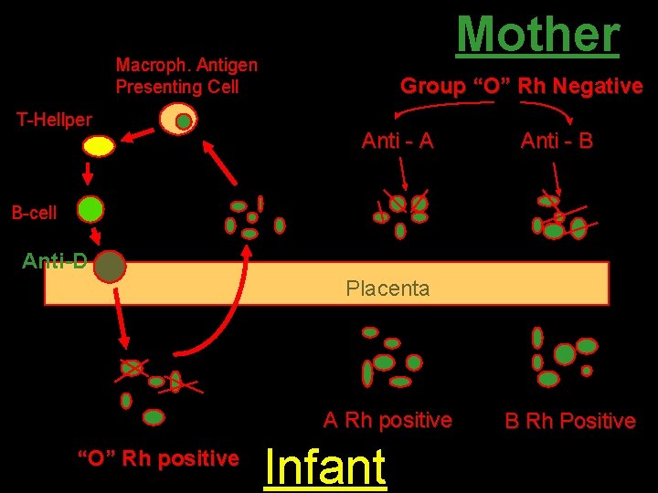 Mother Macroph. Antigen Presenting Cell T-Hellper Group “O” Rh Negative Anti - A Anti