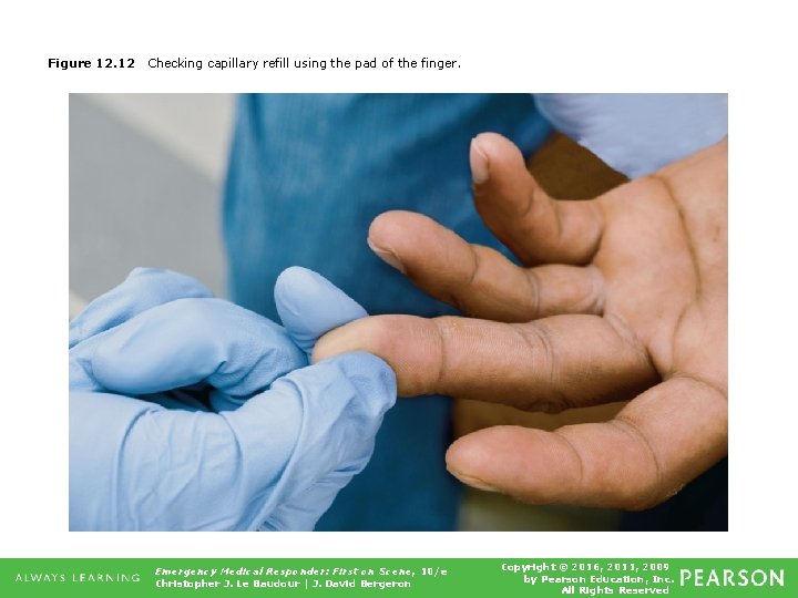 Figure 12. 12 Checking capillary refill using the pad of the finger. Emergency Medical