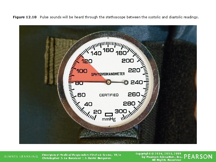 Figure 12. 10 Pulse sounds will be heard through the stethoscope between the systolic