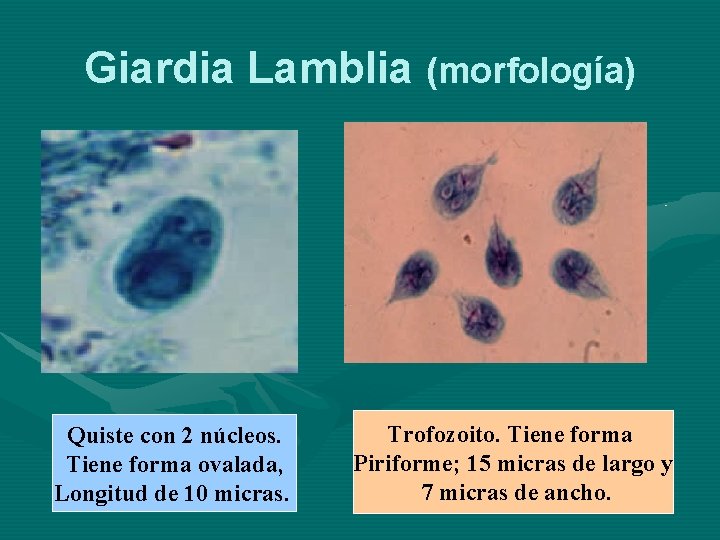 Giardia Lamblia (morfología) Quiste con 2 núcleos. Tiene forma ovalada, Longitud de 10 micras.